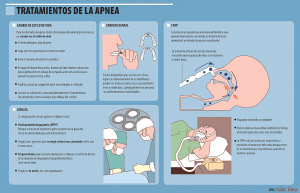 Información sobre la Apnea del sueño - Imagen 02