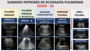 Patrones de ecografía pulmonar